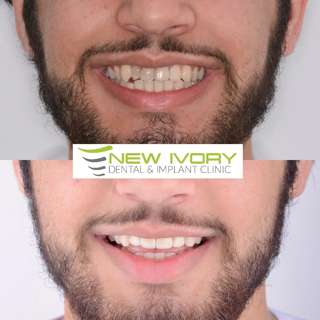 Cosmetic dentistry