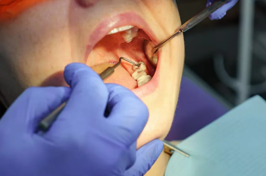 Dental implants and oral surgery
