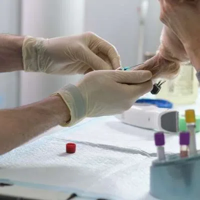 Laboratory blood-test vials
