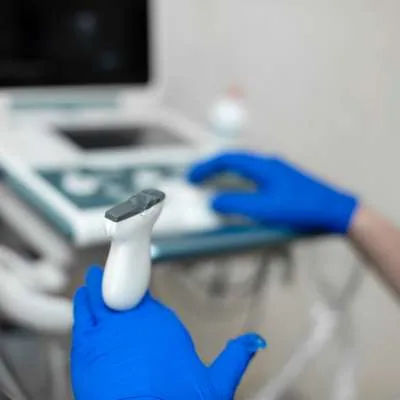 Ultrasound diagnostic equipment