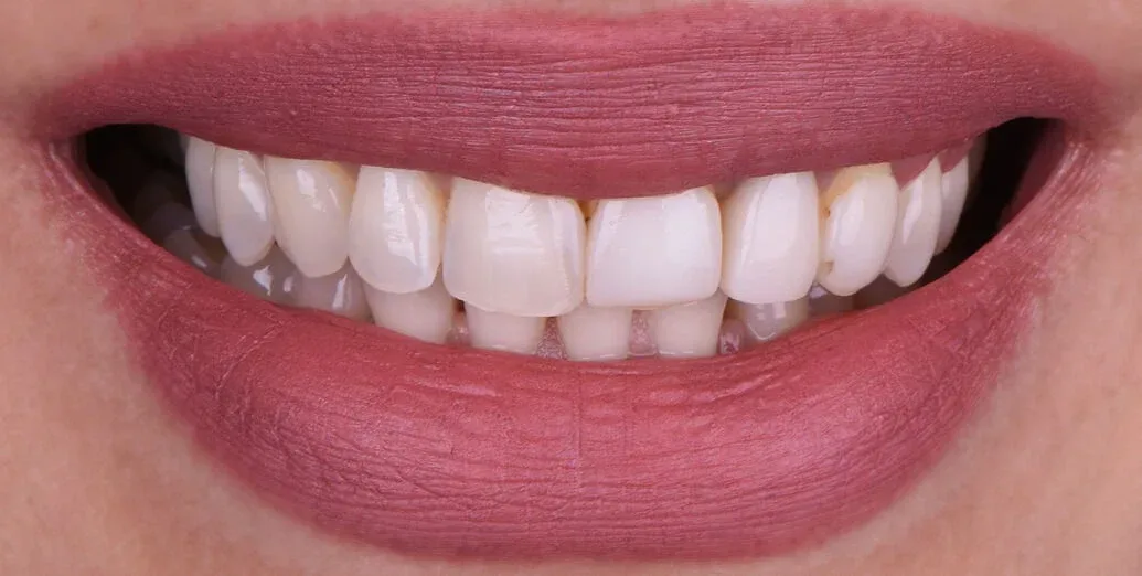 Before treatment
