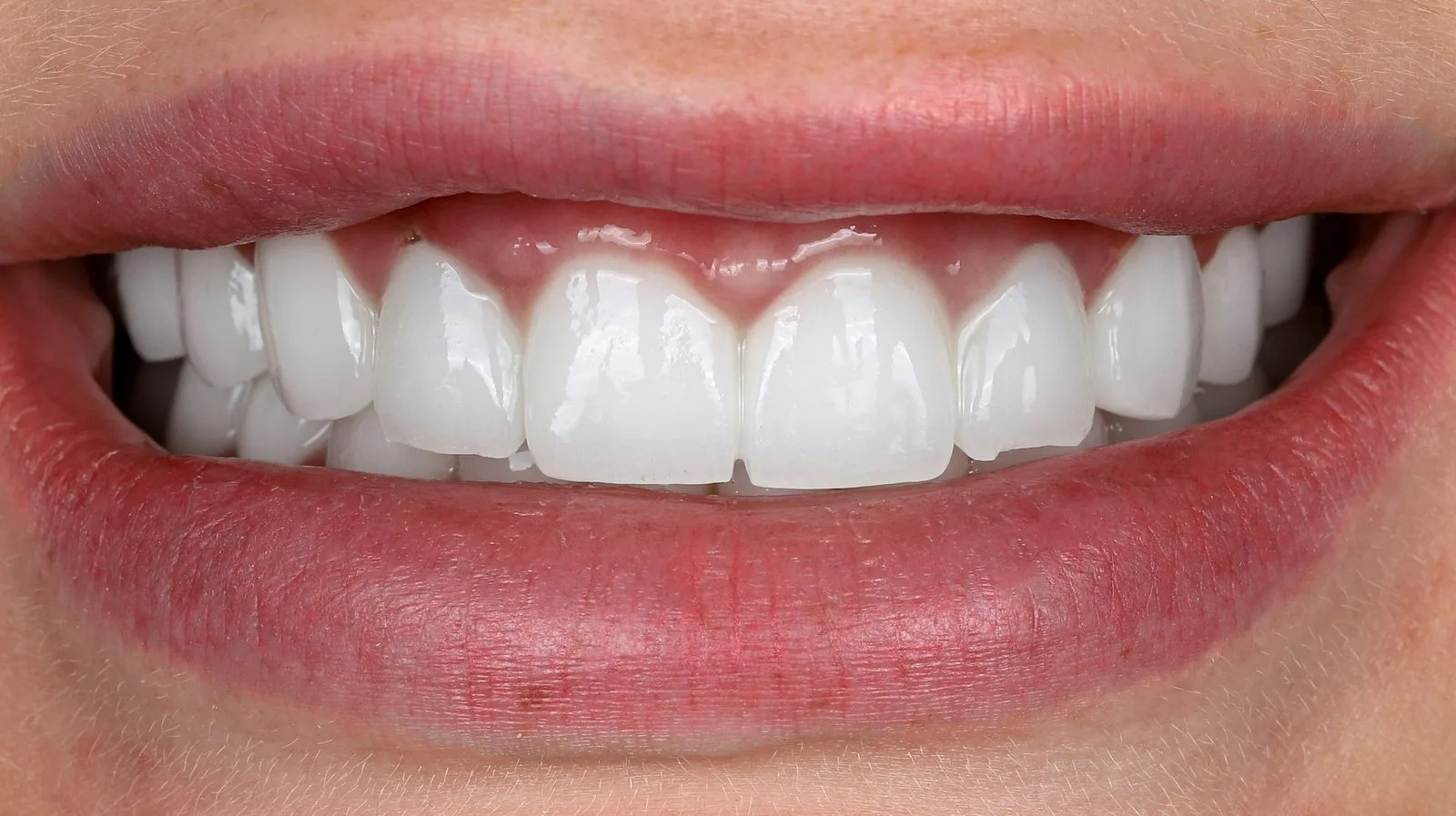 A bright, natural-looking smile