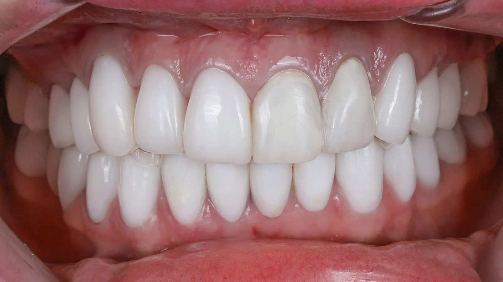 Even, healthy smile detail